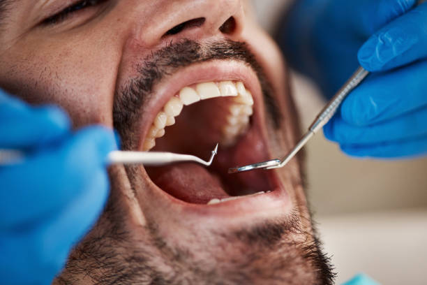 Best Emergency Cosmetic Dentistry (e.g., broken veneers) in Bexley, OH