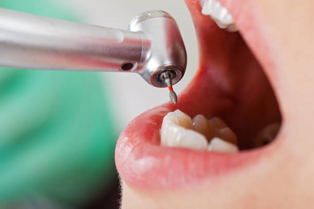 Best Emergency Treatment for Jaw Pain or Injury in Bexley, OH